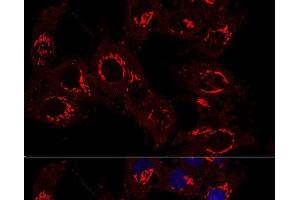 Confocal immunofluorescence analysis of Hela cells using GM130 Polyclonal Antibody at dilution of 1:400.