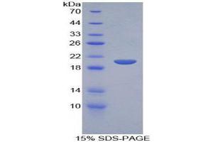 SDS-PAGE (SDS) image for Secretory Leukocyte Peptidase Inhibitor (SLPI) (AA 20-131) protein (His tag) (ABIN1171327) (SLPI Protein (AA 20-131) (His tag))