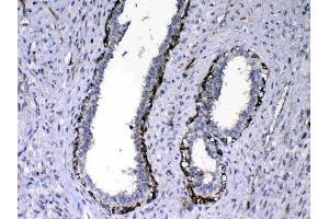IHC analysis of NOV/CCN3 using anti-NOV/CCN3 antibody . (NOV anticorps  (C-Term))