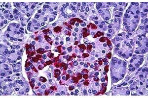 Human Pancreas, Islets of Langerhans: Formalin-Fixed, Paraffin-Embedded (FFPE)