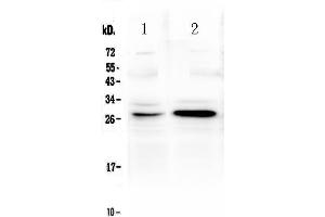 Western blot analysis of TNFRSF18 using anti-TNFRSF18 antibody . (TNFRSF18 anticorps  (AA 178-241))