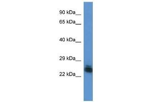 Western Blot showing FYTTD1 antibody used at a concentration of 1.
