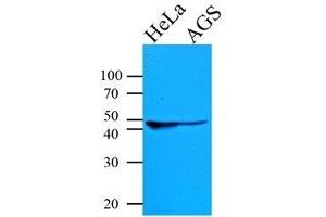 Western Blotting (WB) image for anti-Keratin 18 (KRT18) antibody (ABIN567623)