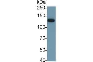 Detection of ITGaV in Mouse Stomach lysate using Polyclonal Antibody to Integrin Alpha V (ITGaV) (CD51 anticorps  (AA 71-322))