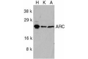 Western blot analysis of ARC in HeLa (H), KB (K), and A549 (A) whole cell lysates with AP30076PU-N ARC antibody at 1/1000 dilution. (NOL3 anticorps  (C-Term))