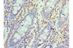 Immunohistochemistry of paraffin-embedded human colon tissue using ABIN7164673at dilution of 1:100 (PD-L1 anticorps  (AA 19-238))