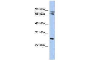 WB Suggested Anti-OVOL2 Antibody Titration: 0. (OVOL2 anticorps  (Middle Region))
