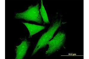 Immunofluorescence of purified MaxPab antibody to KLC2 on HeLa cell.