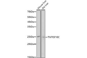 Western blot analysis of extracts of various cell lines, using TNFRSF10C antibody (ABIN3021517, ABIN3021518, ABIN3021519 and ABIN6215183) at 1:1000 dilution. (DcR1 anticorps  (AA 30-130))