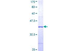 Image no. 1 for Glutamate Receptor, Ionotropic, Kainate 3 (GRIK3) (AA 151-250) protein (GST tag) (ABIN1355742)