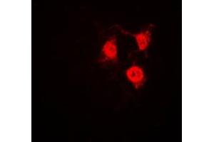 Immunofluorescent analysis of CDK2 staining in Jurkat cells. (CDK2 anticorps  (C-Term))