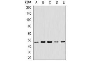 Western blot analysis of CCBL1 expression in Hela (A), A549 (B), mouse liver (C), mouse heart (D), rat kidney (E) whole cell lysates. (CCBL1 anticorps)