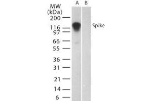 Image no. 1 for anti-SARS-Coronavirus Spike Protein (SARS-CoV S) (AA 19-35) antibody (ABIN199988) (SARS-CoV Spike anticorps  (AA 19-35))