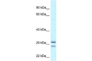 Western Blot showing RIT1 antibody used at a concentration of 1 ug/ml against THP-1 Cell Lysate (RIT1 anticorps  (Middle Region))