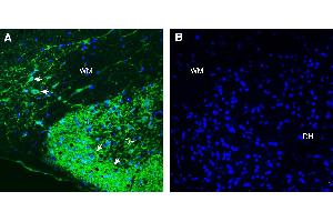 Expression of L1CAM in rat spinal cord. (L1CAM anticorps  (Extracellular))