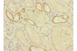 Immunohistochemistry of paraffin-embedded human kidney tissue using ABIN7175037 at dilution of 1:100 (C2ORF76 anticorps  (AA 1-126))