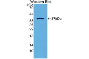 Western Blotting (WB) image for anti-Induced Myeloid Leukemia Cell Differentiation Protein Mcl-1 (MCL1) (AA 2-307) antibody (ABIN1869118) (MCL-1 anticorps  (AA 2-307))