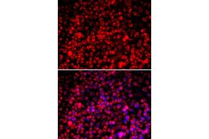 Immunofluorescence analysis of A549 cells using TOMM20 antibody. (TOMM20 anticorps  (AA 20-145))