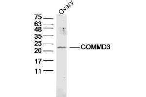 Mouse ovary lysates probed with COMMD3 Polyclonal Antibody, unconjugated  at 1:300 overnight at 4°C followed by a conjugated secondary antibody at 1:10000 for 90 minutes at 37°C.