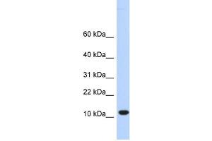 WB Suggested Anti-C10orf57 Antibody Titration:  0. (CJ057 anticorps  (Middle Region))