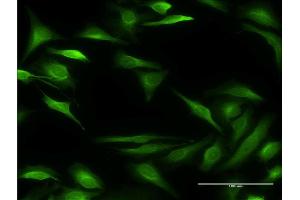 Immunofluorescence of monoclonal antibody to ALOX15B on HeLa cell.