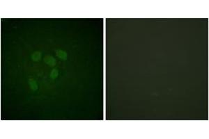 Immunofluorescence analysis of HeLa cells, using p53 (Acetyl-Lys317) Antibody. (p53 anticorps  (acLys317))