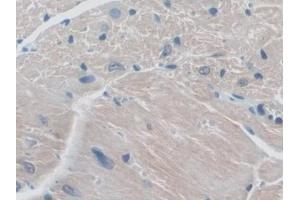 Detection of RANk in Mouse Heart Tissue using Polyclonal Antibody to Receptor Activator Of Nuclear Factor Kappa B (RANk)