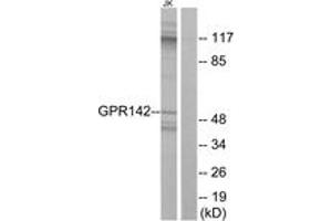 Western blot analysis of extracts from Jurkat cells, using GPR142 Antibody. (GPR142 anticorps  (AA 1-50))