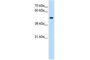 WB Suggested Anti-STYK1 Antibody Titration:  0. (STYK1 anticorps  (C-Term))