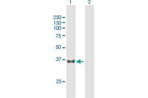 Western Blot analysis of GNPTG expression in transfected 293T cell line by GNPTG MaxPab polyclonal antibody. (GNPTG anticorps  (AA 1-305))