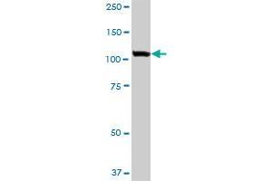 USO1 monoclonal antibody (M03), clone 3F4. (USO1 anticorps  (AA 1-961))