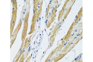 Immunohistochemistry of paraffin-embedded Rat heart using GDAP1 Polyclonal Antibody at dilution of 1:100 (40x lens). (GDAP1 anticorps)