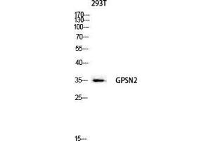 Western Blot (WB) analysis of 293T lysis using GPSN2 antibody. (TECR anticorps  (C-Term))