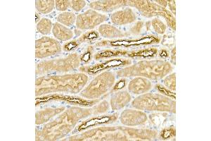 Immunohistochemistry of paraffin-embedded mouse kidney using SLC12 Rabbit pAb (ABIN6131136, ABIN6147843, ABIN6147844 and ABIN6215366) at dilution of 1:50 (40x lens).