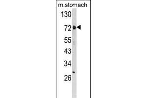 Western blot analysis of ZFP36 Antibody (Center) (ABIN652459 and ABIN2842311) in mouse stomach tissue lysates (35 μg/lane). (ZFP36 anticorps  (AA 119-148))
