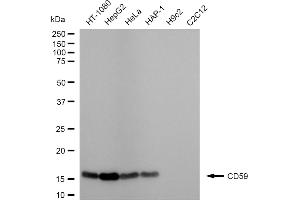 Western blotting analysis using CD59 antibody (ABIN7797978).