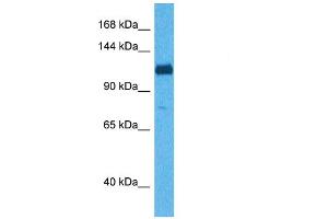 Host:  Rabbit  Target Name:  ABI3BP  Sample Tissue:  Human 293T Whole Cell  Antibody Dilution:  1ug/ml (ABI3BP anticorps  (C-Term))