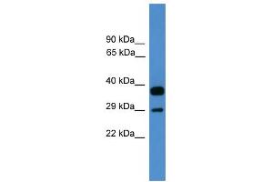 WB Suggested Anti-OTUB2 Antibody Titration: 0. (OTUB2 anticorps  (Middle Region))