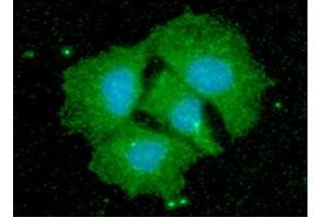 ICC/IF analysis of CPOX in Hep3B cells line, stained with DAPI (Blue) for nucleus staining and monoclonal anti-human CPOX antibody (1:100) with goat anti-mouse IgG-Alexa fluor 488 conjugate (Green). (CPOX anticorps  (AA 111-454))