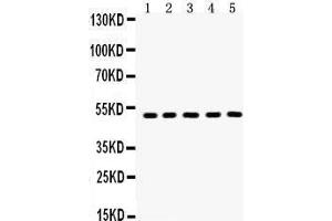 Anti- Aquaporin 2 Picoband antibody, Western blotting All lanes: Anti Aquaporin 2  at 0. (AQP2 anticorps  (C-Term))