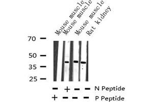 Western blot analysis of Phospho-JunB (Ser259) expression in various lysates (JunB anticorps  (pSer259))