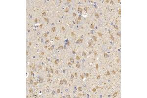 Immunohistochemistry of paraffin embedded rat brain using MAP9 (ABIN7074622) at dilution of 1:750 (300x lens) (MAP9 anticorps)