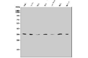 Western blot analysis of Slc25a1 using anti-Slc25a1 antibody (ABIN7602839).
