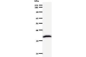 anti-Polymerase (DNA Directed), delta 2, Accessory Subunit (POLD2) (Regulatory Subunit 50) antibody