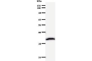 Western Blotting (WB) image for anti-Polymerase (DNA Directed), delta 2, Accessory Subunit (POLD2) (Regulatory Subunit 50) antibody (ABIN931066) (POLD2 anticorps  (Regulatory Subunit 50))