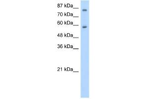WB Suggested Anti-ZNF777 Antibody Titration:  0. (ZNF777 anticorps  (C-Term))