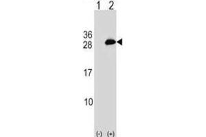 Western Blotting (WB) image for anti-Ubiquitin-Conjugating Enzyme E2T (Ube2t) antibody (ABIN2999419) (Ube2t anticorps)