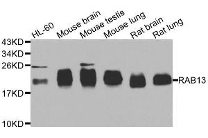 Western blot analysis of extracts of various cell lines, using RAB31 antibody. (RAB31 anticorps  (AA 1-195))
