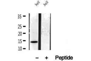 Western blot analysis of extracts of HepG2 cells, using CISD1 antibody. (CISD1 anticorps  (Internal Region))
