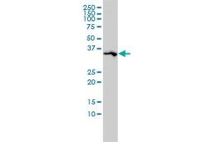 SPARC monoclonal antibody (M02), clone 1B2 Western Blot analysis of SPARC expression in A-431 .